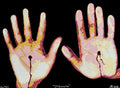 Stigmata